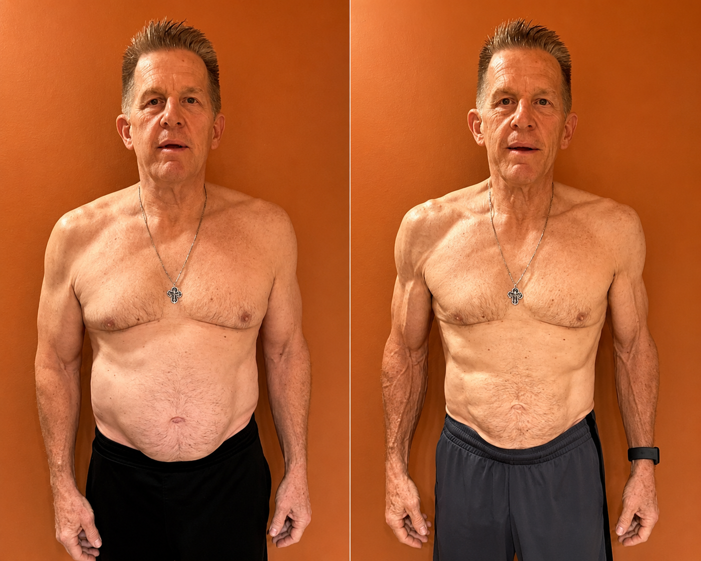 Kevin, 66, before and after